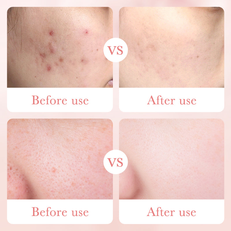 Rose Hyaluronic Acid Moisturizing Cream